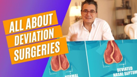 All About Deviation Surgeries - Dr. Abdülkadir Göksel Videos