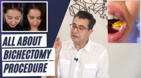 All About Bichectomy Procedure video