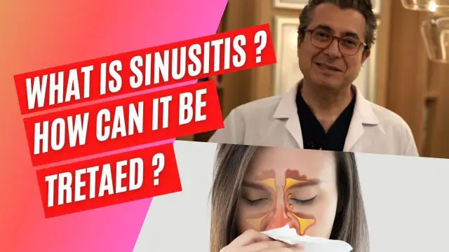 What is Sinusitis? How Can it Be Tretaed? Video
